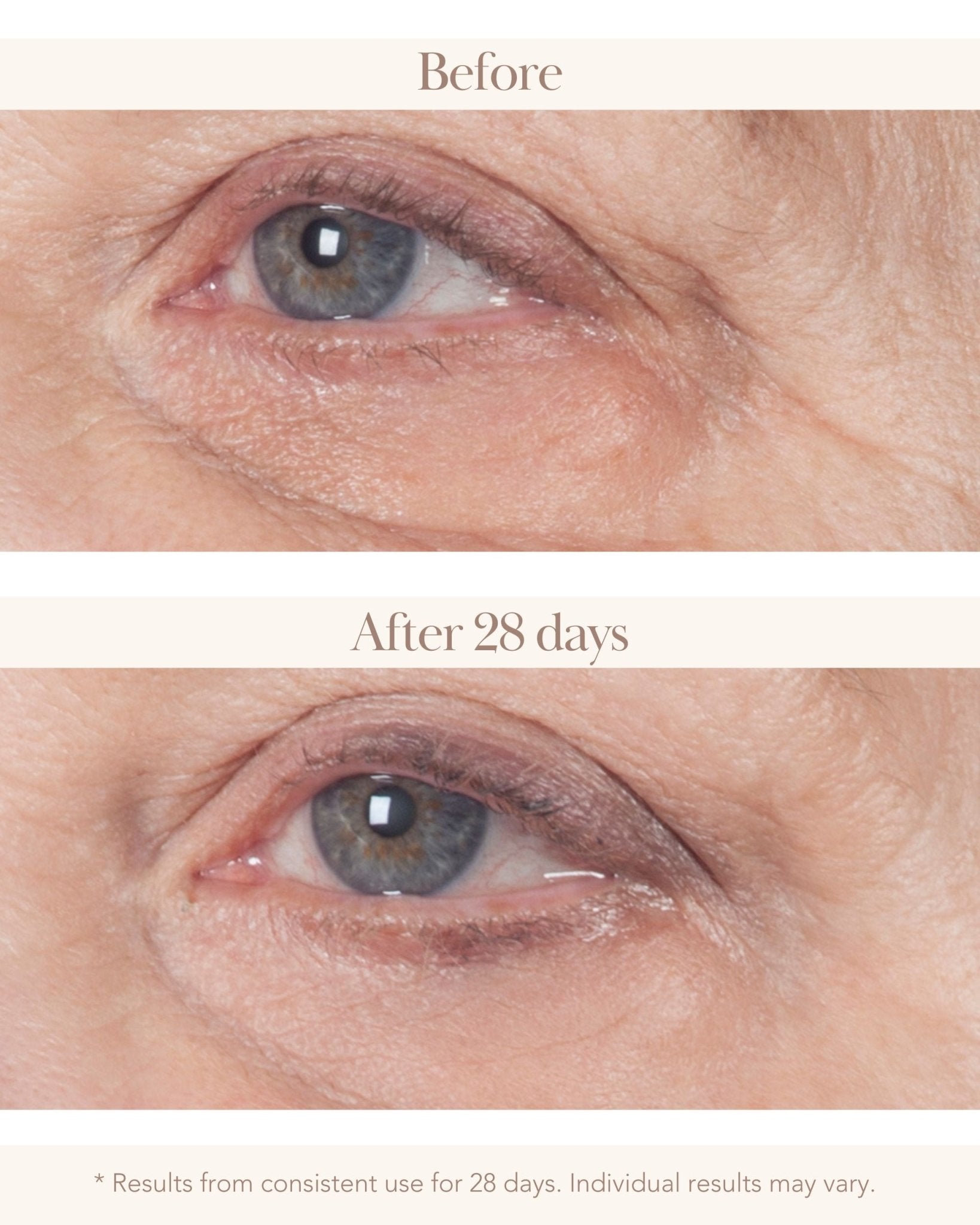 Collagen Re-Inforce 3D Crepey Eye Lift